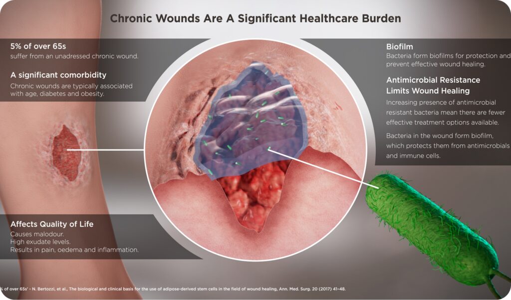 Diagram illustrating chronic wounds and their effects on health.